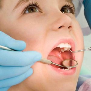 Wisdom teeth Get It Removed With Dental Clinic Kids