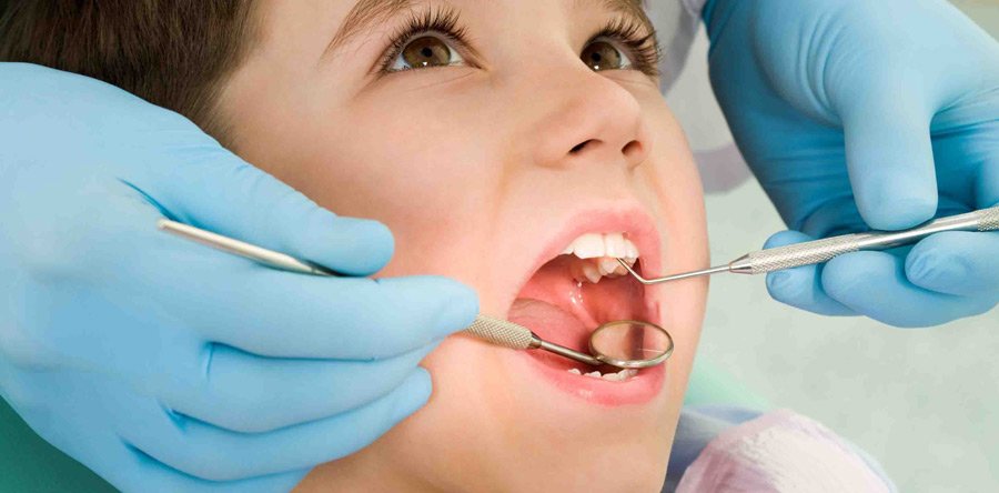 Wisdom teeth: Get It Removed With Dental Clinic Kids